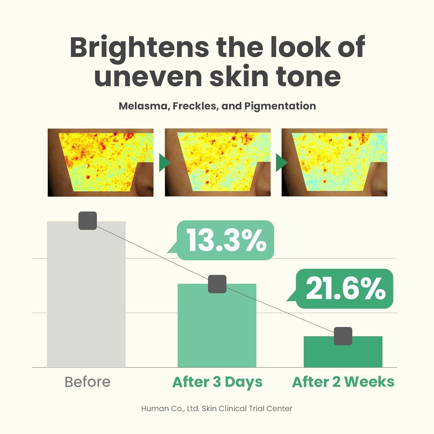 AXIS-Y Dark Spot Correcting Serum for Glowing Skin