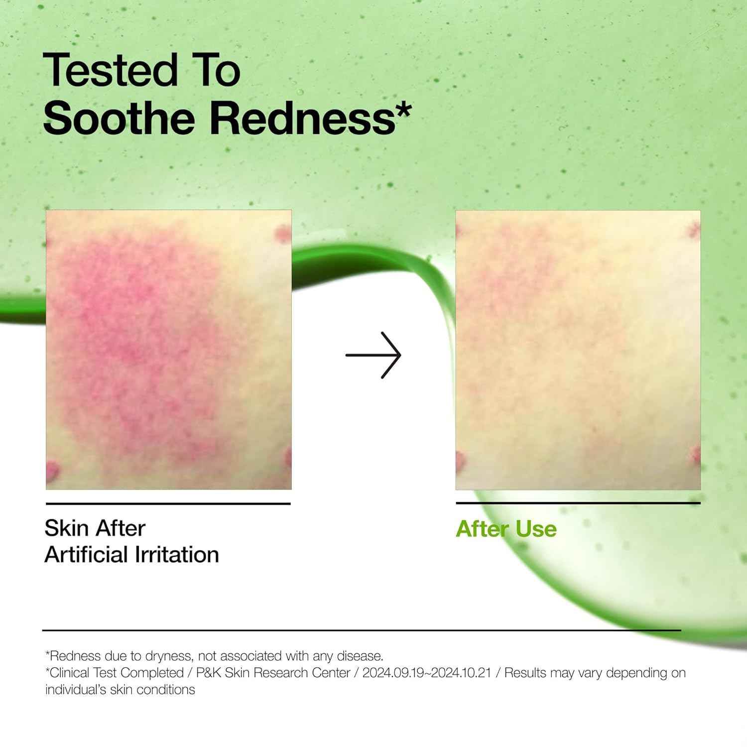 Anua Azelaic Acid Redness Soothing Serum