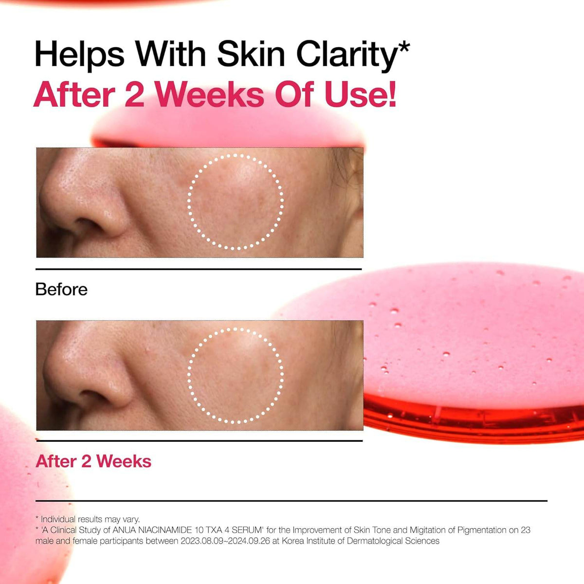 Anua Niacinamide Serum for Dark Spots